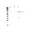 Forkhead Box P2 antibody, A01329-1, Boster Biological Technology, Western Blot image 