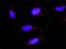 Zinc Finger And BTB Domain Containing 16 antibody, H00007704-M01, Novus Biologicals, Proximity Ligation Assay image 