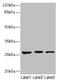 Kallikrein Related Peptidase 6 antibody, CSB-PA842165LA01HU, Cusabio, Western Blot image 