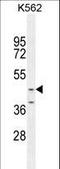 Otoconin 90 antibody, LS-C163099, Lifespan Biosciences, Western Blot image 