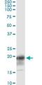 CD247 Molecule antibody, H00000919-M01, Novus Biologicals, Immunoprecipitation image 