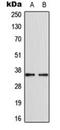 Cyclin Dependent Kinase Like 4 antibody, orb224151, Biorbyt, Western Blot image 