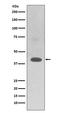 Translocation Associated Membrane Protein 2 antibody, M11792, Boster Biological Technology, Western Blot image 