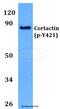 Cortactin antibody, A01253Y421, Boster Biological Technology, Western Blot image 
