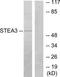 STEAP3 Metalloreductase antibody, TA315576, Origene, Western Blot image 