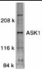 Mitogen-Activated Protein Kinase Kinase Kinase 5 antibody, MBS150980, MyBioSource, Western Blot image 