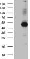 Glycerol-3-phosphate acyltransferase 3 antibody, TA809765S, Origene, Western Blot image 