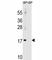Microtubule Associated Protein 1 Light Chain 3 Alpha antibody, F46103-0.4ML, NSJ Bioreagents, Western Blot image 