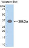 RACK7 antibody, MBS2002425, MyBioSource, Western Blot image 