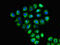Solute Carrier Family 6 Member 13 antibody, LS-C679525, Lifespan Biosciences, Immunofluorescence image 