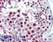 Forkhead Box P2 antibody, LS-B15176, Lifespan Biosciences, Immunohistochemistry paraffin image 