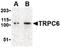 Transient Receptor Potential Cation Channel Subfamily C Member 6 antibody, LS-C19628, Lifespan Biosciences, Western Blot image 