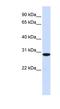 Replication Protein A4 antibody, NBP1-58157, Novus Biologicals, Western Blot image 