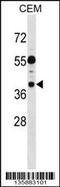EARP Complex And GARP Complex Interacting Protein 1 antibody, 58-795, ProSci, Western Blot image 