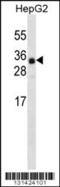 Ankyrin Repeat Domain 46 antibody, 56-405, ProSci, Western Blot image 