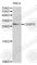 CCAAT Enhancer Binding Protein Delta antibody, A2862, ABclonal Technology, Western Blot image 