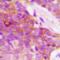 Mucin 1, Cell Surface Associated antibody, orb393332, Biorbyt, Immunohistochemistry paraffin image 