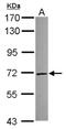 Transketolase Like 2 antibody, NBP2-20650, Novus Biologicals, Western Blot image 