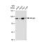 Inhibitor Of Nuclear Factor Kappa B Kinase Subunit Beta antibody, GTX01197, GeneTex, Western Blot image 