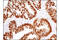 Caudal Type Homeobox 2 antibody, 12306S, Cell Signaling Technology, Immunohistochemistry paraffin image 