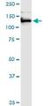 Extended Synaptotagmin 1 antibody, H00023344-B01P, Novus Biologicals, Western Blot image 