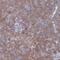 Transmembrane Protein 128 antibody, NBP1-92516, Novus Biologicals, Immunohistochemistry paraffin image 