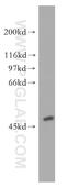 Acyl-CoA Thioesterase 2 antibody, 15633-1-AP, Proteintech Group, Western Blot image 