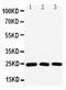 RAB11A, Member RAS Oncogene Family antibody, PA2282, Boster Biological Technology, Western Blot image 