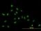 Zinc Finger Protein 593 antibody, H00051042-B01P, Novus Biologicals, Immunocytochemistry image 