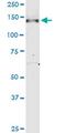 Nephrocystin 3 antibody, MA5-24451, Invitrogen Antibodies, Western Blot image 