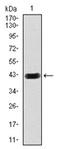 Hexosaminidase Subunit Alpha antibody, AM06756PU-N, Origene, Western Blot image 