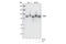 Dishevelled Segment Polarity Protein 2 antibody, 3224T, Cell Signaling Technology, Western Blot image 