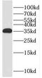 Regulator Of Calcineurin 2 antibody, FNab07202, FineTest, Western Blot image 