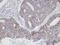 Actin Related Protein 2/3 Complex Subunit 3 antibody, GTX101982, GeneTex, Immunohistochemistry paraffin image 