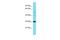 Ring Finger Protein 149 antibody, A13275, Boster Biological Technology, Western Blot image 