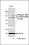 Fatty Acid Binding Protein 1 antibody, orb146712, Biorbyt, Western Blot image 