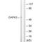 Death Associated Protein Kinase 3 antibody, A03300, Boster Biological Technology, Western Blot image 