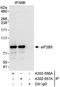 Eukaryotic Translation Initiation Factor 2B Subunit Epsilon antibody, A302-557A, Bethyl Labs, Immunoprecipitation image 
