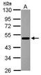 IKAROS Family Zinc Finger 3 antibody, PA5-30443, Invitrogen Antibodies, Western Blot image 