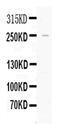 Apolipoprotein B antibody, PA5-78799, Invitrogen Antibodies, Western Blot image 