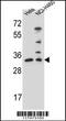 Nth Like DNA Glycosylase 1 antibody, 55-909, ProSci, Western Blot image 
