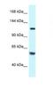 Tubulin Folding Cofactor D antibody, NBP1-79913, Novus Biologicals, Western Blot image 