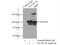 Exosome Component 10 antibody, 16731-1-AP, Proteintech Group, Immunoprecipitation image 