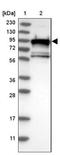 Slingshot Protein Phosphatase 3 antibody, NBP1-83804, Novus Biologicals, Western Blot image 