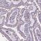 Cathepsin Z antibody, NBP2-38703, Novus Biologicals, Immunohistochemistry paraffin image 