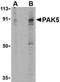 P21 (RAC1) Activated Kinase 5 antibody, orb74488, Biorbyt, Western Blot image 