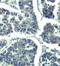 Phospholipase C Gamma 2 antibody, LS-C336062, Lifespan Biosciences, Immunohistochemistry paraffin image 
