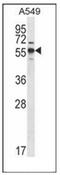 Sphingolipid Transporter 3 (Putative) antibody, AP54027PU-N, Origene, Western Blot image 