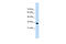 ADAM Metallopeptidase With Thrombospondin Type 1 Motif 4 antibody, 29-597, ProSci, Enzyme Linked Immunosorbent Assay image 