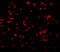 Insulin Receptor Substrate 1 antibody, 3521, ProSci, Immunofluorescence image 